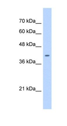 ST6GALNAC6 antibody