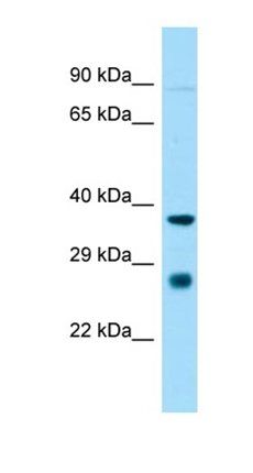 St8sia1 antibody