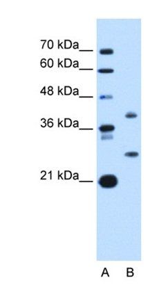 ST8SIA2 antibody