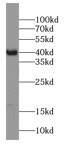 ST8SIA2-Specific antibody