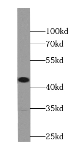 ST8SIA3 antibody