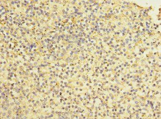 STAB2 Antibody