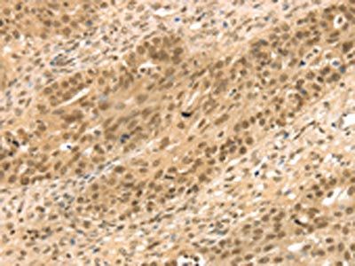 STAG2 Antibody