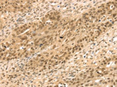 STAG2 antibody