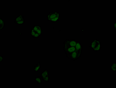 STAG2 Recombinant Monoclonal Antibody