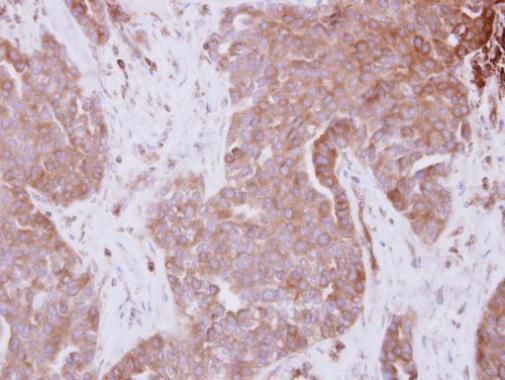 STAM Rabbit Polyclonal Antibody