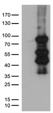 Stanniocalcin 1 (STC1) antibody