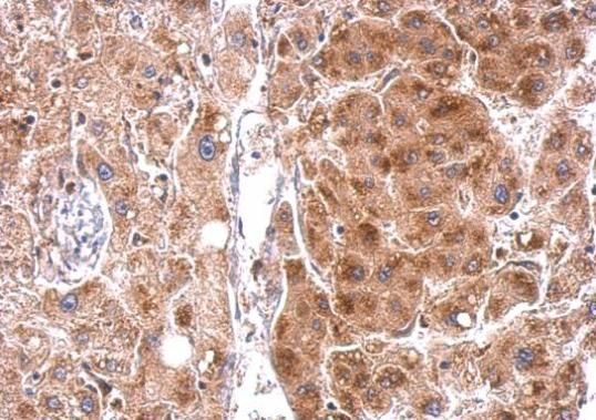 StAR Rabbit Polyclonal Antibody