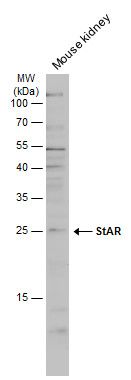 StAR Rabbit Polyclonal Antibody
