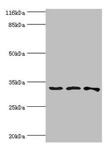 STARD10 Antibody