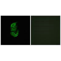 STARD13 Antibody