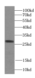 STARD3NL antibody