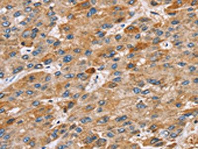 STARD8 Antibody