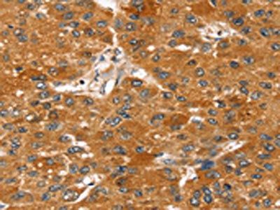 STARD8 Antibody
