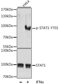 STAT1 (Phospho-Y701) antibody