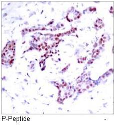 STAT1 (Phospho-Tyr701) Antibody