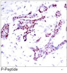 STAT1 (Phospho-Tyr701) Antibody