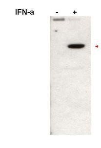 STAT2 (phospho-Y690) antibody