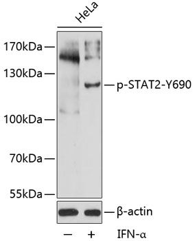 STAT2 (Phospho-Y690) antibody