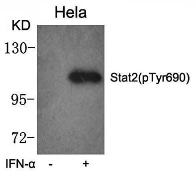 Stat2 (phospho-Tyr690) Antibody