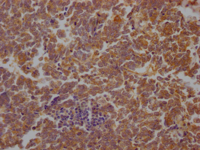 STAT3 Recombinant Monoclonal Antibody