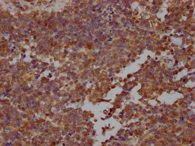 STAT3 Recombinant Monoclonal Antibody