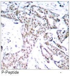 STAT3 (Phospho-Ser727) Antibody
