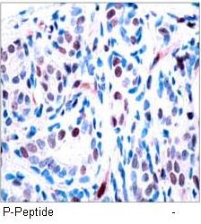 STAT3 (Phospho-Tyr705) Antibody