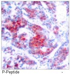 STAT4 (Phospho-Tyr693) Antibody