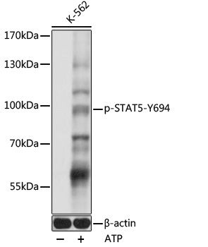 STAT5 (Phospho-Y694) antibody