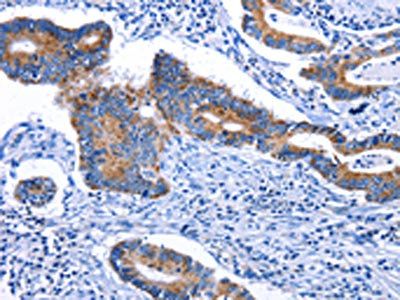 STAT5A Antibody