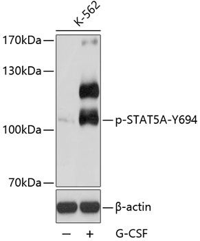 STAT5A (Phospho-Y694) antibody