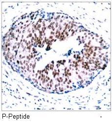 STAT5A (Phospho-Ser780) Antibody