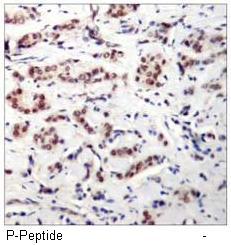 STAT5A (Phospho-Tyr694) Antibody