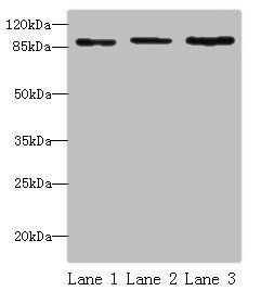 STAT5B Antibody