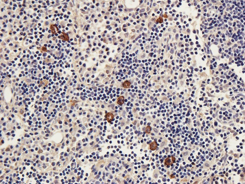 STAT5B antibody