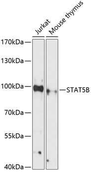 STAT5B antibody