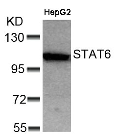 STAT6 (Ab-641) antibody