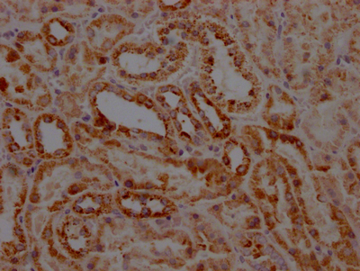 STAT6 Recombinant Monoclonal Antibody