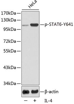 STAT6 (Phospho-Y641) antibody