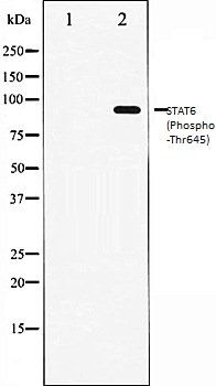 IL4 (Phospho-Thr645) antibody