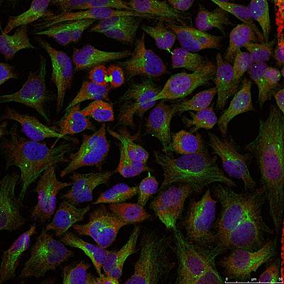 Stathmin 1 (Ab-25) Antibody