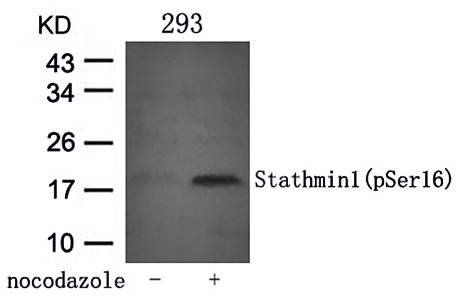 Stathmin 1 (Phospho-Ser16) Antibody