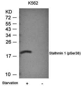 Stathmin 1 (Phospho-Ser38) Antibody