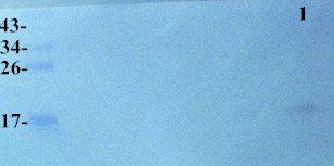 Stathmin Rabbit Polyclonal Antibody