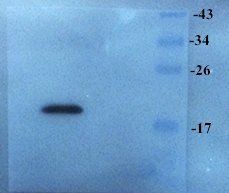 Stathmin antibody