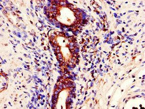 STAU1 Antibody