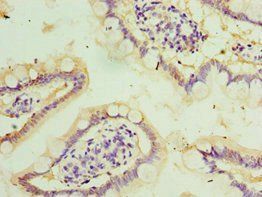 STAU2 Antibody