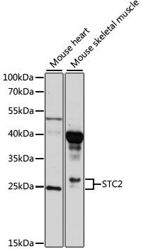 STC2 antibody