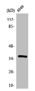 STEAP1 antibody